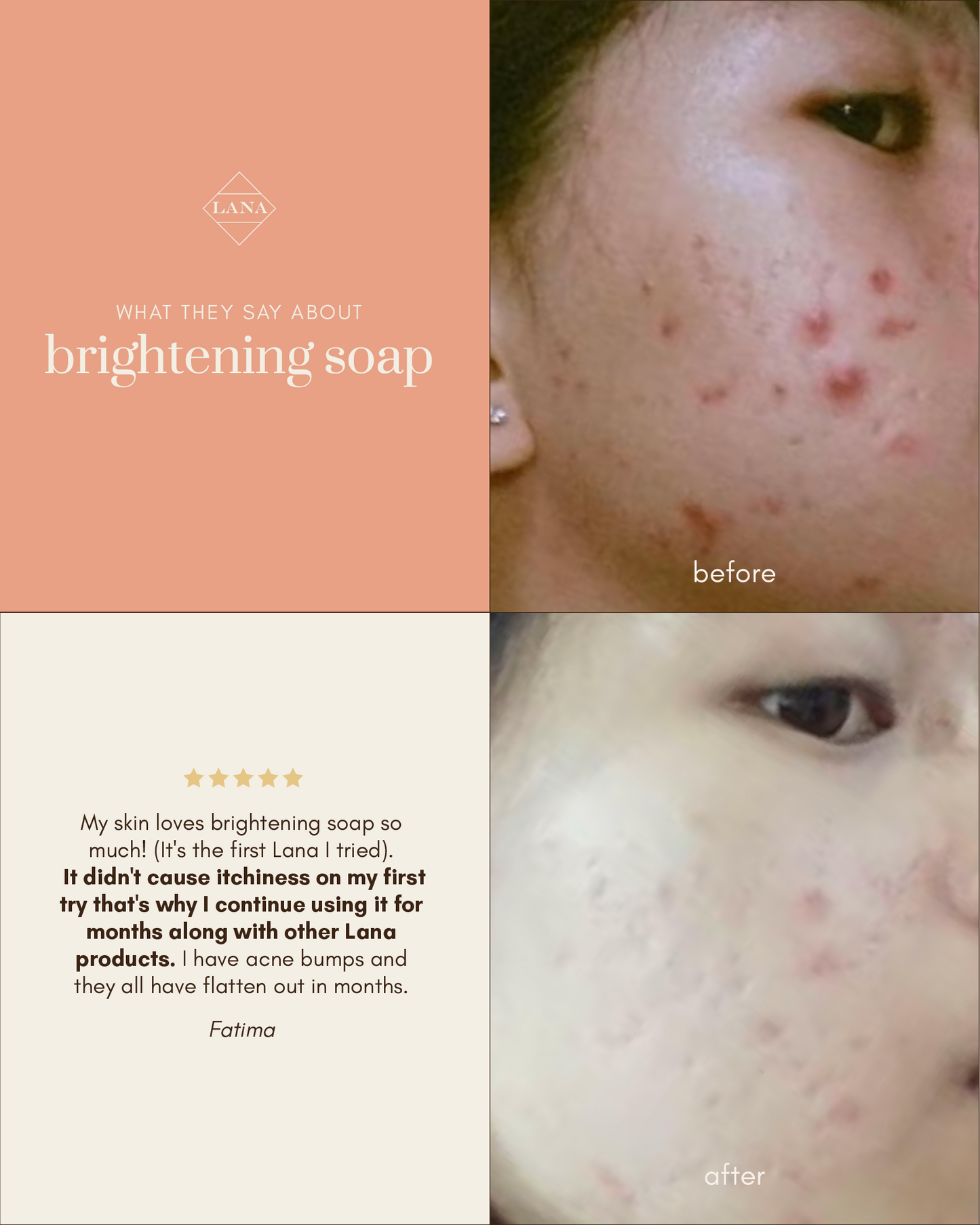 Brightening Soap